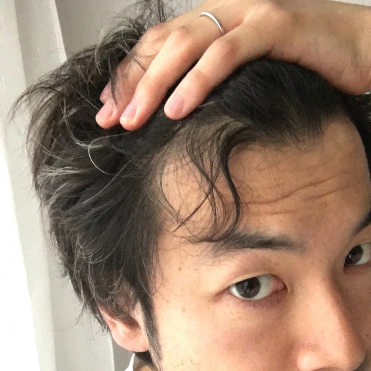 【自らのくせで実証！】うねる顔まわりのくせを1分で直す方法 ショートヘアのトリセツ