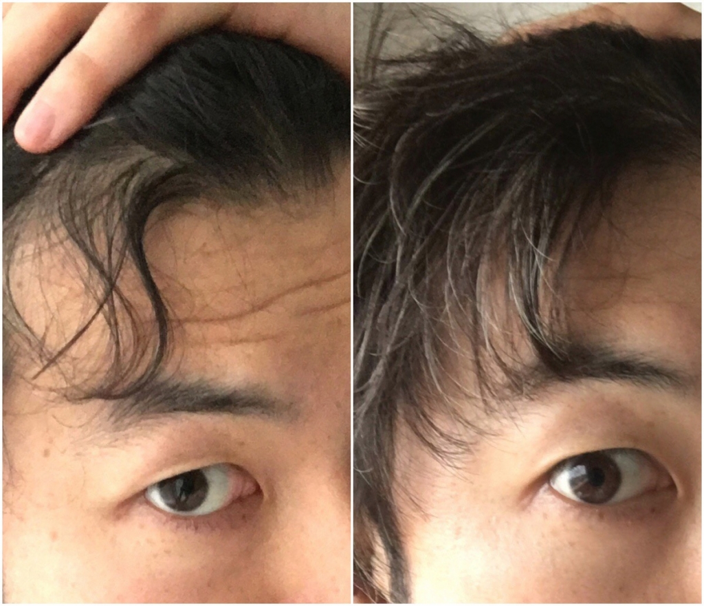 【自らのくせで実証！】うねる顔まわりのくせを1分で直す方法 ショートヘアのトリセツ